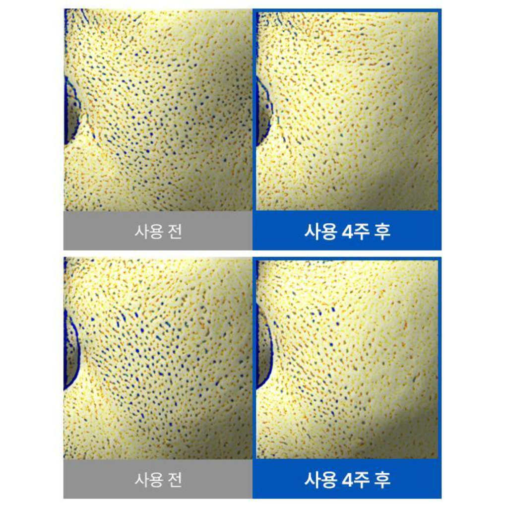 ANUA 8 Hyaluronic Acid Catechin Calming Pad