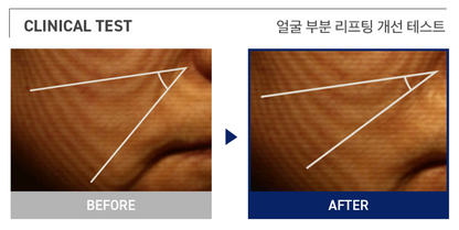 MEDIHEAL Retinol Collagen Lifting Pad