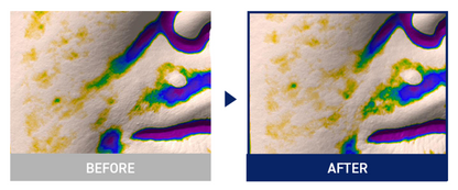 MEDIHEAL Retinol Collagen Lifting Pad