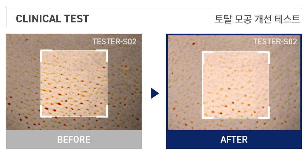 MEDIHEAL Phyto-enzyme Peeling Pad