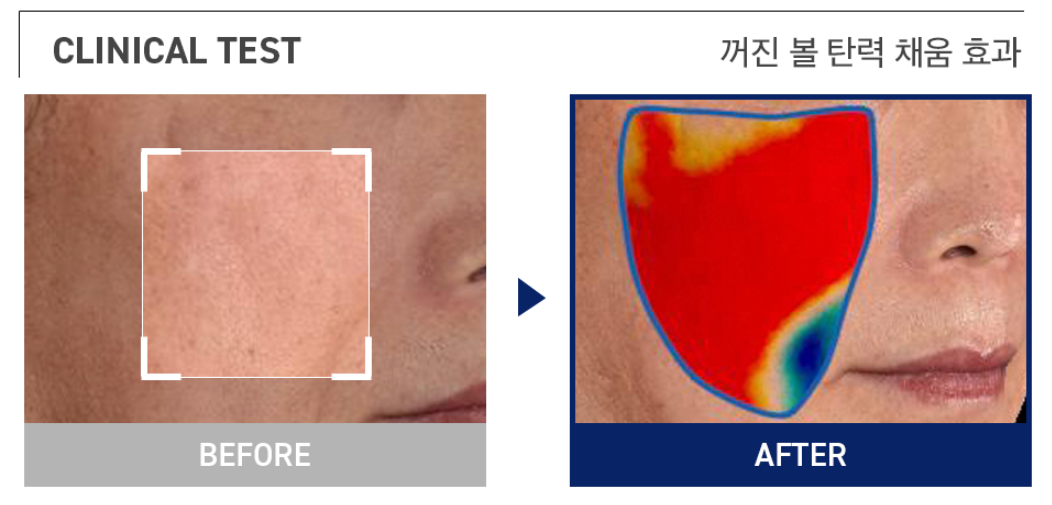 MEDIHEAL Collagen Ampoule Pad