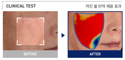 MEDIHEAL Collagen Ampoule Pad