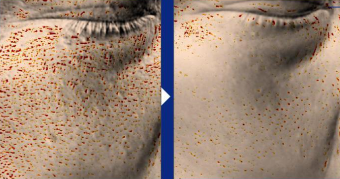 Torhop Saunan Salt Mask