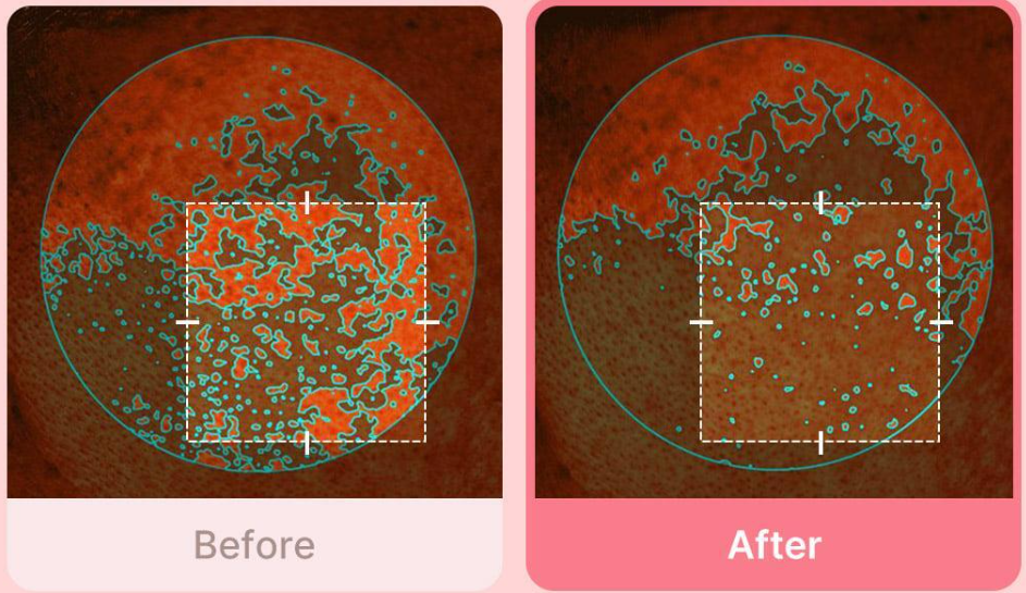 MEDICUBE Pdrn Pink Collagen Toning Gel Toner Pad