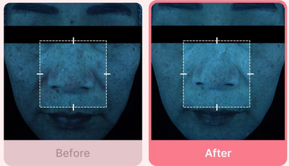 MEDICUBE Pdrn Pink Collagen Toning Gel Toner Pad